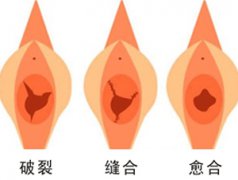 和田處女膜修補(bǔ)手術(shù)哪家醫(yī)院好